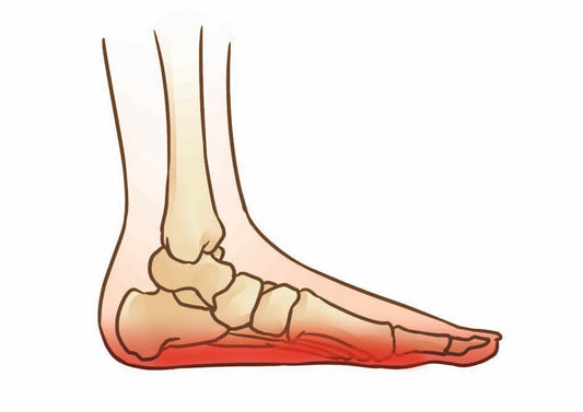 FLAT FEET